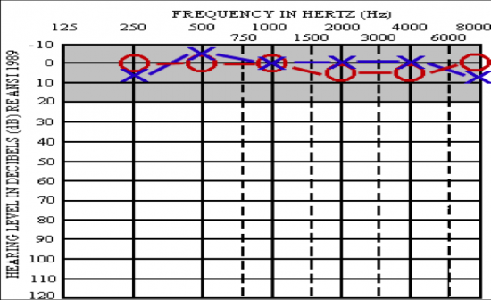 Question 11