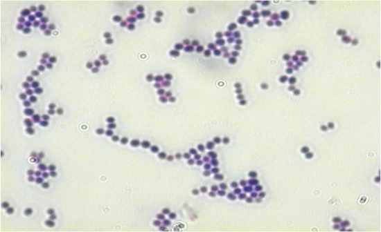 Ininns Microbiology Lab Final - Flashcards